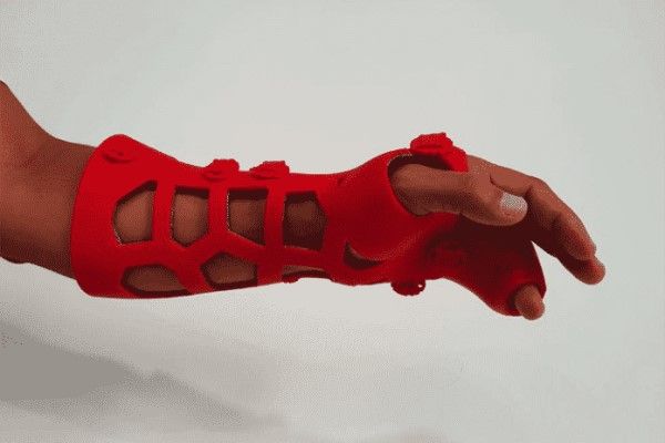 Hombre con una férula que le inmoviliza la muñeca y varios dedos