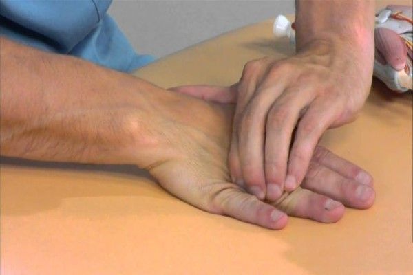 Metacarpianos y falanges - medico sujetándose la mano con signos de tener una falange rota