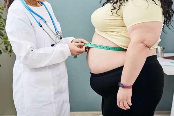 Factores de riesgo cardiovascular- Paciente obesa que puede generar problemas al corazón por el sobrepeso
