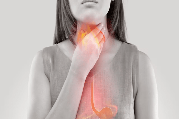 Mujer tocándose la garganta con ilustración de reflujo gástrico síntoma de motilidad intestinal
