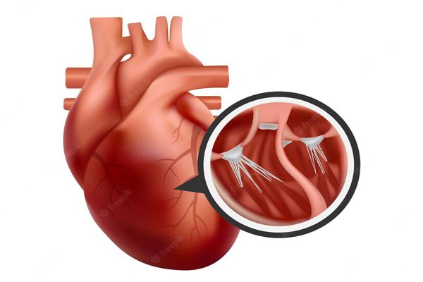 Insuficiencia cardíaca- Corazon mostrando sus válvulas