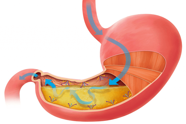 Gráfico del sistema digestivo con posibles alteraciones