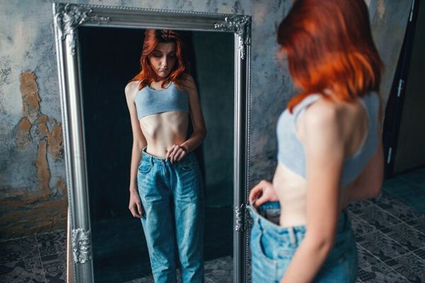 Diferencia entre anorexia y bulimia- Joven con bulimia y muy bajo peso, viendose al espejo