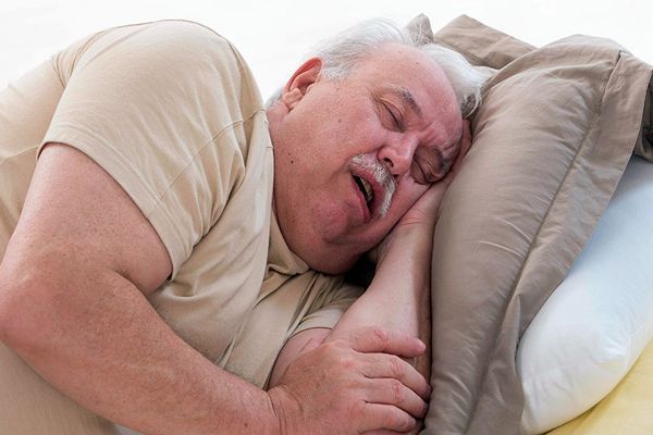 Apnea del sueño