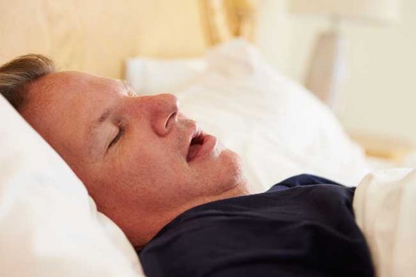 Apnea del sueño