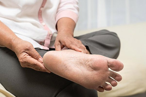 Adulta mayor con pie inflamado visiblemente cansada