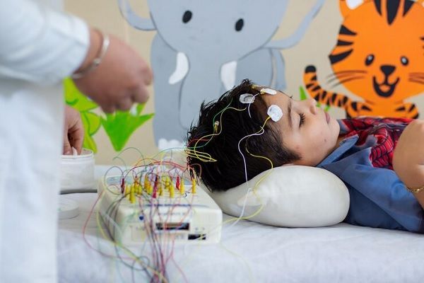 Síndrome de Dravet- Medico neuropediatra examina un niño