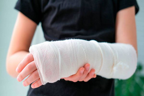 Osteogénesis - Niño con brazo fracturado sostiene su yeso para mantener la elevación correcta