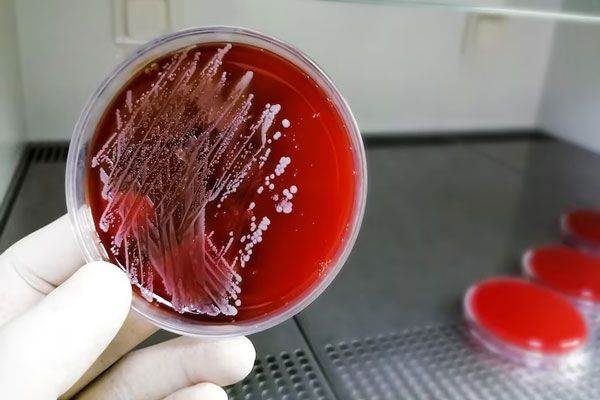 Prueba de tinción de Gram para determinar la presencia de bacterias en el organismo