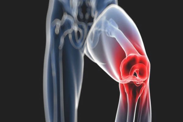 Cáncer de huesos - Radiografía da cuenta un tumor en el tejido articular
