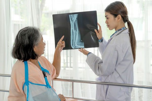 Osteomielitis - Radióloga le enseña a una imagen a una mujer mayor que refleja una notable fractura del brazo