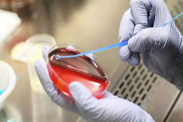 Osteomielitis - Especialista en microbacteriología prepara todo para llevar a cabo un hemocultivo que será evaluado en un laboratorio