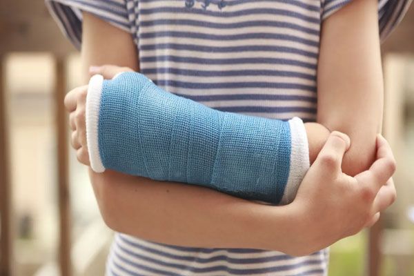 Osteogénesis imperfecta - Niña sostiene su brazo con delicadeza tras la disposición de un yeso parcial