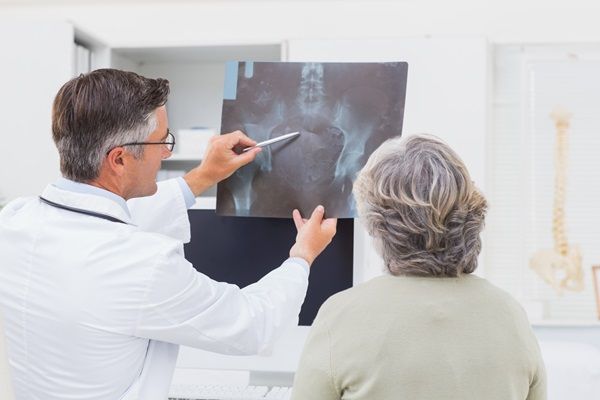 Osteonecrosis - Doctor evaluando la radiografía de una paciente, para determinar si sufre de la enfermedad en los huesos llamada osteonecrosis