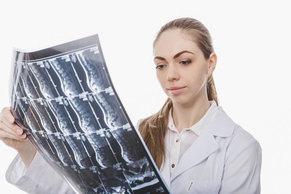 Osteonecrosis - Doctora evaluando las radiografías de un paciente, para determinar con exactitud si presenta una enfermedad en los huesos