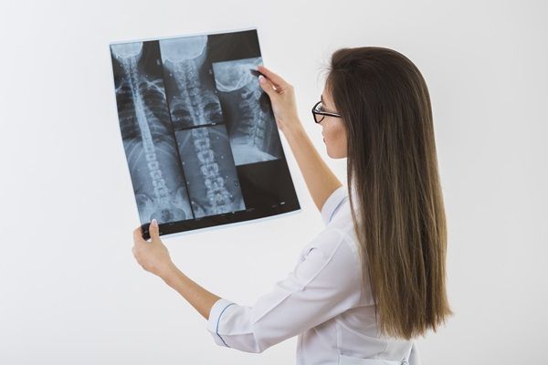 Enfermedad ósea de Paget - Doctora evaluando la radiografía de un paciente, para determinar si posee una enfermedad en el esqueleto