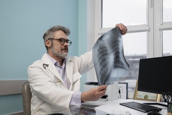 Enfermedad ósea de Paget - Doctor analizando la radiografía de un paciente, para diagnosticar si posee una enfermedad en el esqueleto