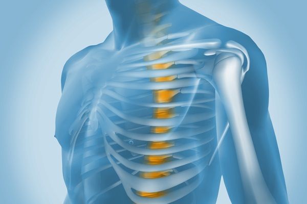 Joroba - Imagen representativa de una persona con joroba, ya que presenta una curvatura anormal en la parte superior de la columna vertebral