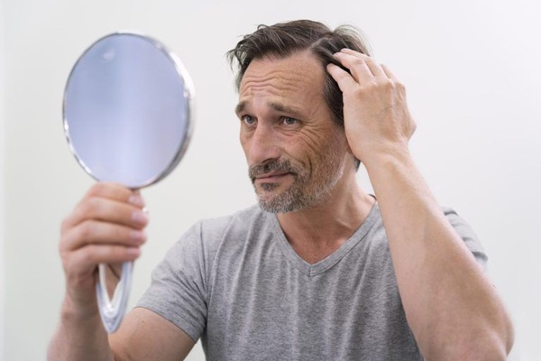 Tipos de alopecia - Hombre observando el avance de la calvicie antes de realizarse un tratamiento de injerto capilar Madrid