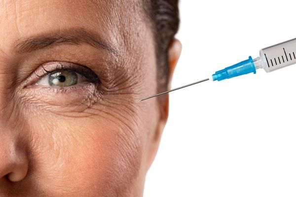 Envejecimiento prematuro - Mujer recibiendo un tratamiento de bótox Madrid para eliminar las arrugas del rostro que aparecen al envejecer