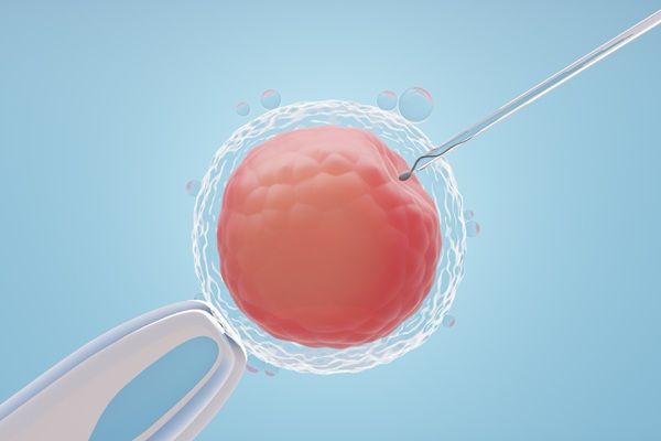 Fecundación in vitro - Representación de la inseminación artificial mediante el procedimiento de fecundacion in vitro para lograr la fertilizacion