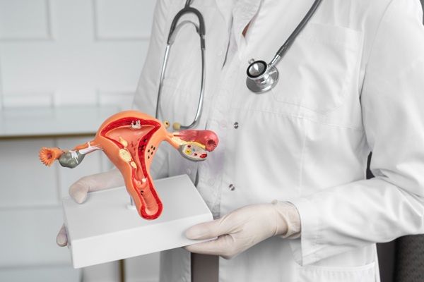 VPH - Doctor sosteniendo una maqueta del cuello uterino con ETS a causa de una infección de transmisión sexual