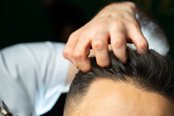 Injerto capilar en Madrid - Mejor cirujano capilar España evaluando el crecimiento del cabello de un paciente luego del trasplante capilar Madrid exitoso en la mejor clínica injerto capilar Madrid