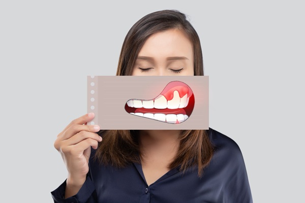 Enfermedades bucales - Mujer sosteniendo una foto de enfermedades en los dientes causadas por no prestar importancia de la higiene bucal