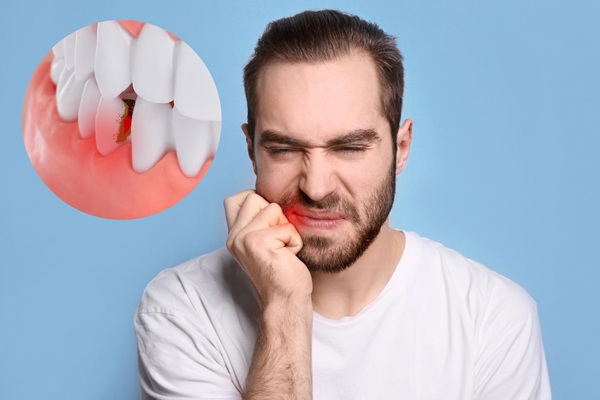 Enfermedades bucales - Hombre con dolor en los dientes causado por infecciones orales al no tomar importancia de la higiene bucal