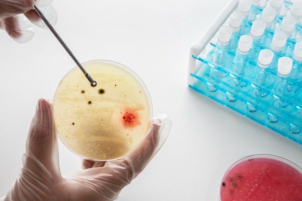 Enfermedades de transmisión sexual - Médico analizando una muestra para detectar la presencia de infecciones por ETS