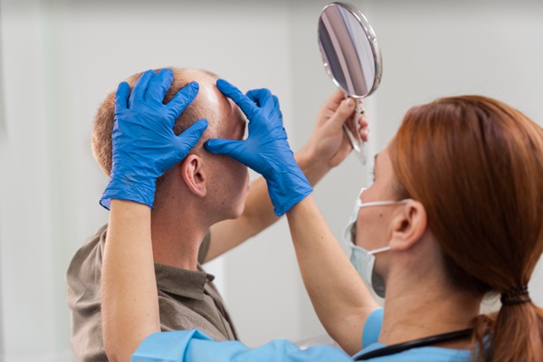 Implante capilar precio - Médico capilar evaluando a un hombre con alopecia en la mejor clínica injerto capilar Madrid