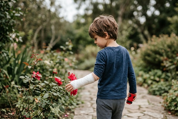 Insensibilidad congénita al dolor - Niño con un brazo lesionado sin sentir dolor debido a la analgesia congénita