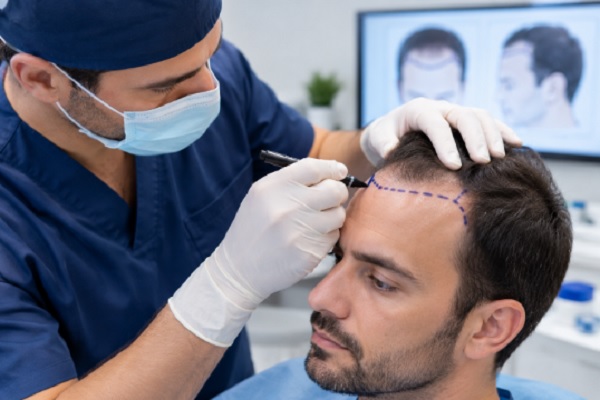 Médico realizando diseño de línea frontal